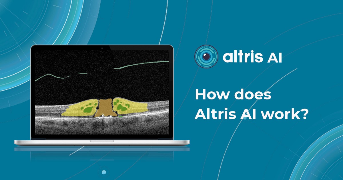 Enhancing diagnostic accuracy with AI-driven analysis